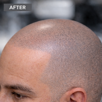 72229720-C7FA-4851-B399-ABB1A3980014