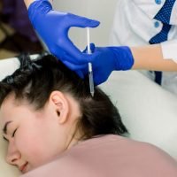 Hair loss problem, mesotherapy. Woman with hair loss problem receiving injection in beauty center